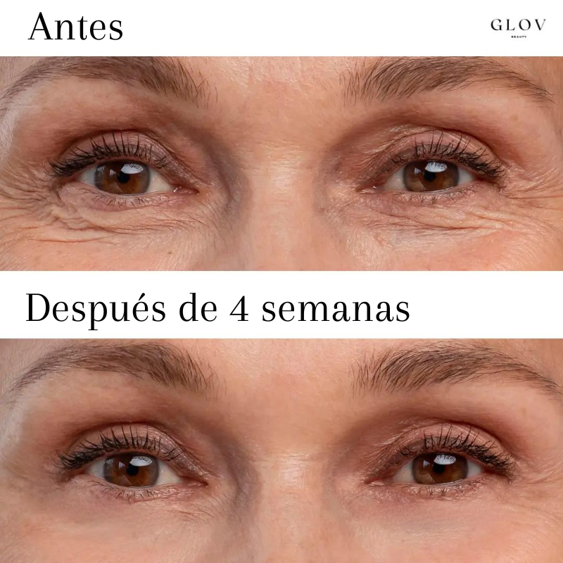 Antes (1).png__PID:a5bf944c-a9fd-4858-95a0-b1ccdf3e63f5